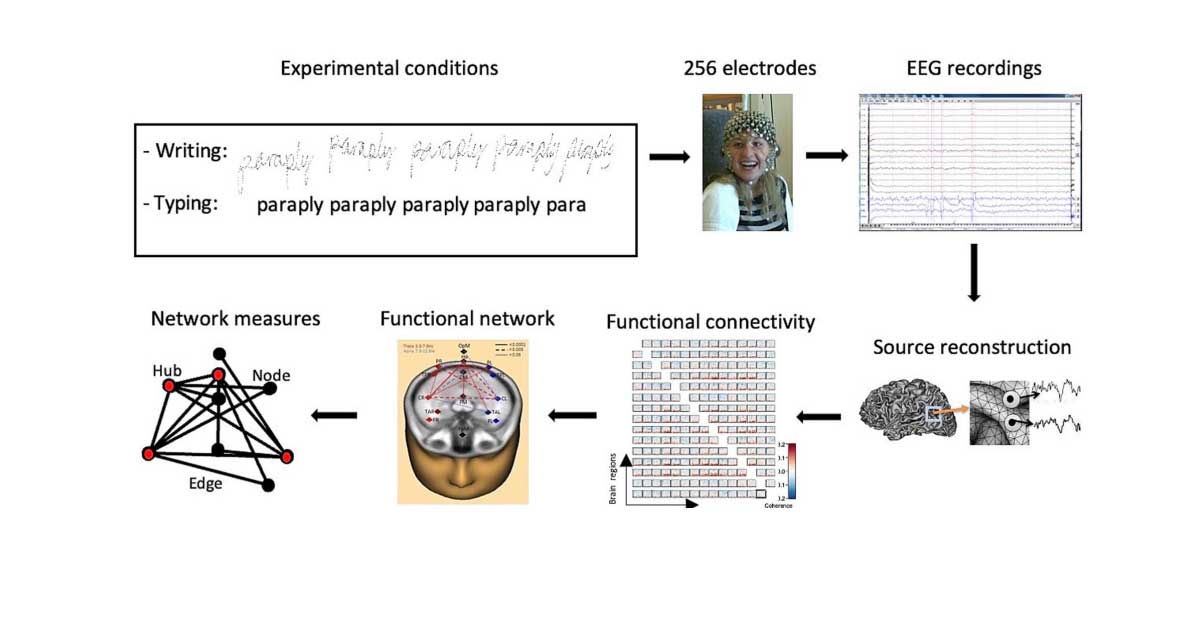 EEG ölçüm sistemi